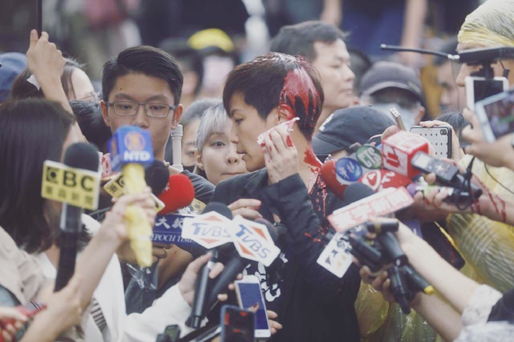 Pro-Hong Kong campaigner in singer Denise Ho after the attack. -- Instagram/ hoccgoomusic
