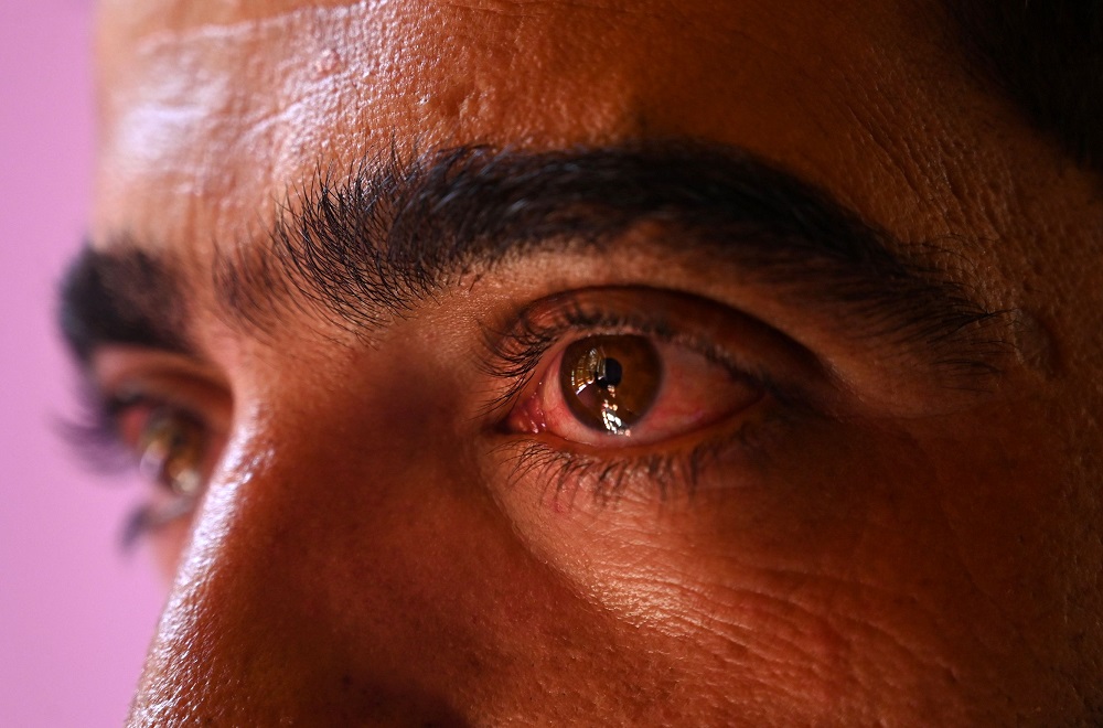 In this photograph taken on September 12, 2019, Abid Khan, 26, looks on during an interview with AFP at Haripora village in Shopian district, in the Indian state of Jammu and Kashmir. u00e2u20acu201d AFP pic           