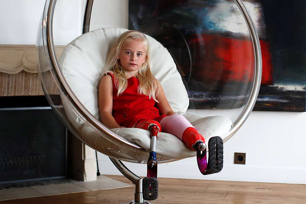 Model Daisy-May Demetre, a nine-year-old double amputee who will walk the runway during Paris Fashion Week, a day before the show of luxury children's wear label Lulu et Gigi in Paris, France September, 26, 2019. u00e2u20acu201d Reuters pic