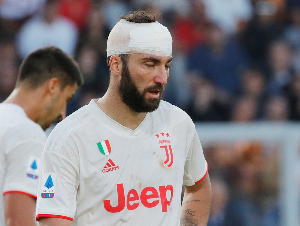 Juventusu00e2u20acu2122 Gonzalo Higuain is seen with his head bandaged during the Serie A match with Lecce at Stadio Via del Mare in Lecce October 26, 2019. u00e2u20acu201d Reuters pic