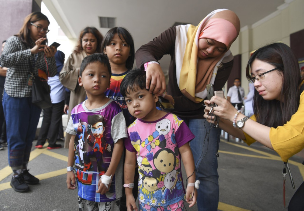 Sri Rahayu Sugiono shows a burn on her daughter Nur Haffiqah Khalid, 4, from the helium balloons while her two other children look on in Putrajaya October 12, 2019. u00e2u20acu201d Bernama pic 