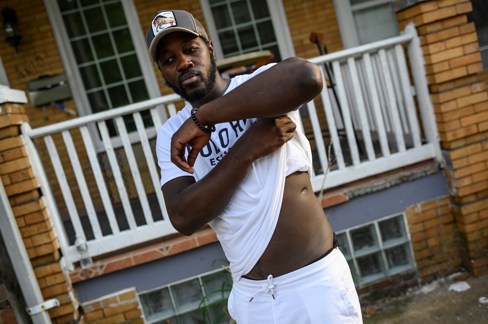 Baltimore resident and gunshot survivor Antonio Pinder, 31, shows his scars in front of his uncle house in West Baltimore September 12, 2019. — AFP pic