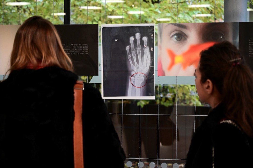 Visitors view an X-ray of a woman’s broken wrist displayed during the exhibition ‘Invisibility Is Not A Super Power’ at the San Carlo Hospital in Milan November 22, 2019. — AFP pic