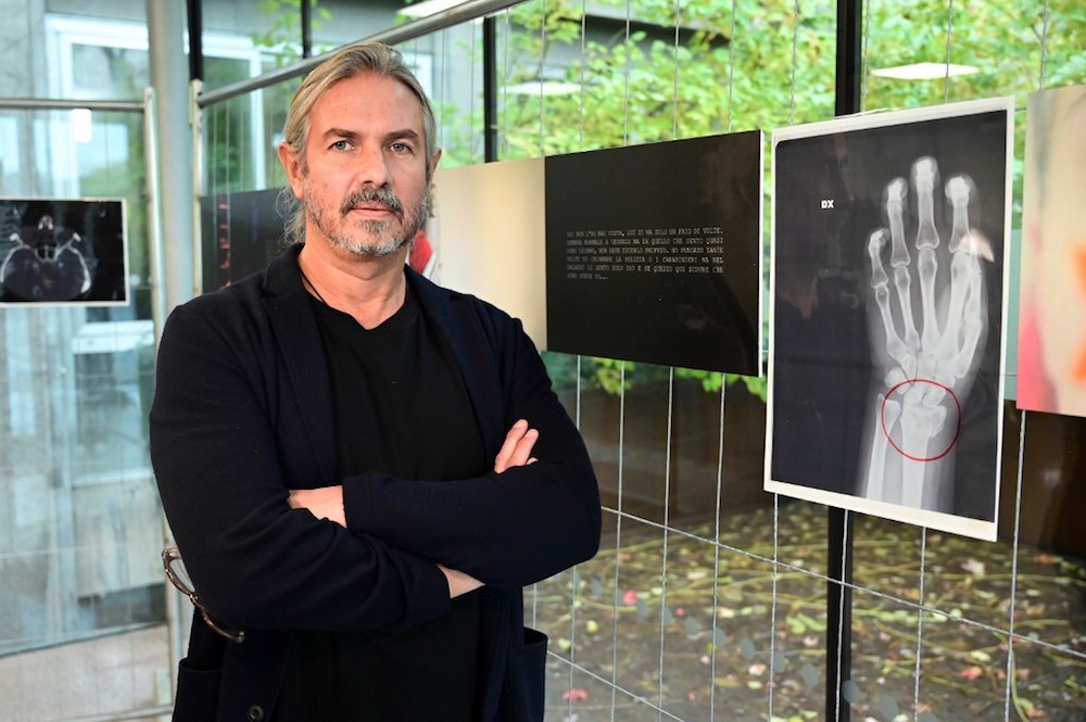 Luca Lo Presti, founder of the Pangea Onlus association, poses next to a picture of an X-ray of a woman’s broken wrist displayed during the exhibition ‘Invisibility Is Not A Super Power’ at the San Carlo Hospital in Milan November 22, 2019. — AFP