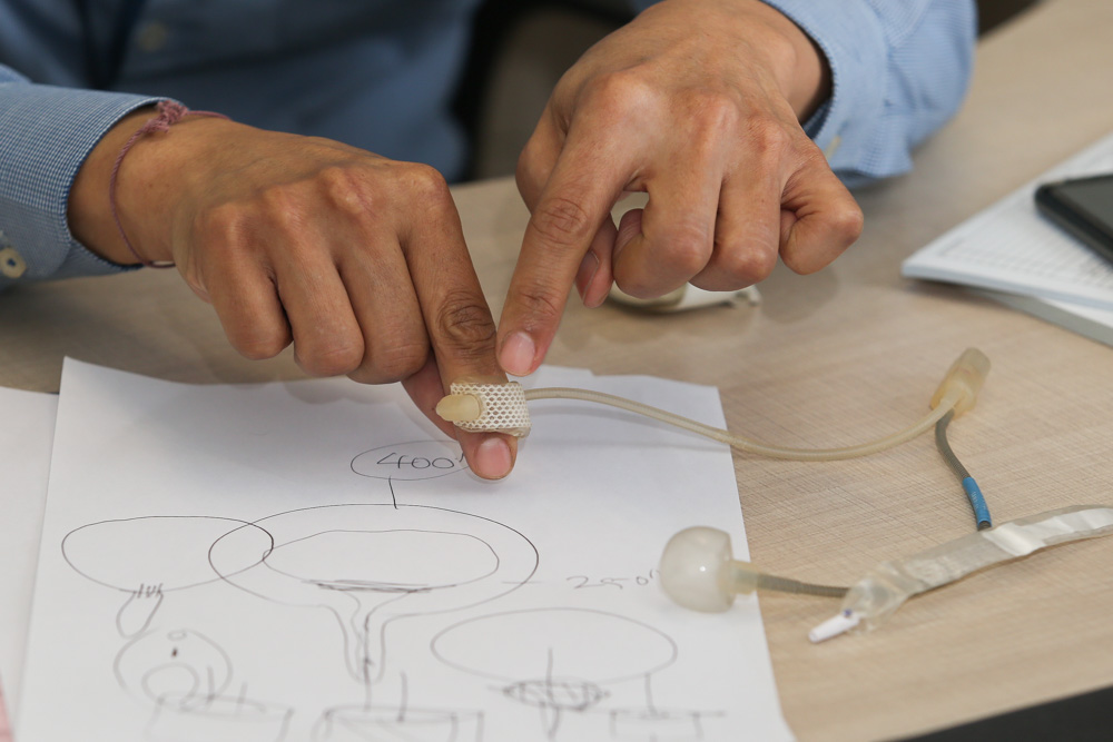 Artificial urinary sphincter is an implanted device to treat moderate to severe stress urinary incontinence. — Picture by Choo Choy May