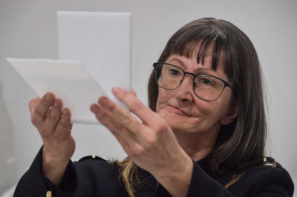 Denise Vicentin, who lost her right eye and part of her jaw to cancer, looks in the mirror for the first time after getting a digitally-engineered prosthesis, in Sao Paulo, Brazil December 3, 2019. u00e2u20acu201d AFP pic  