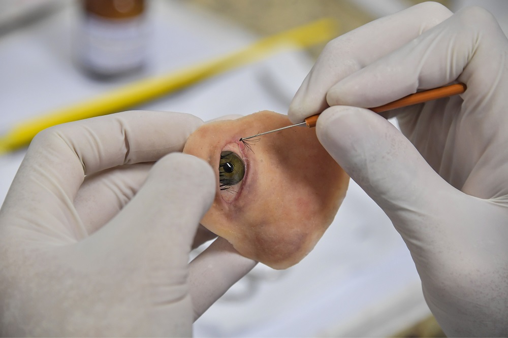 Doctor Rodrigo Salazar-Gamarra works on a digitally-engineered prosthesis for Denise Vicentin, a woman who lost her right eye and part of her jaw to cancer, in Sao Paulo, Brazil December 3, 2019. — AFP pic