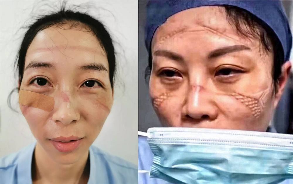 The nurses were praised for bravely facing the Covid-19 threat head-on. u00e2u20acu201d Pictures from Twitter/PDChina