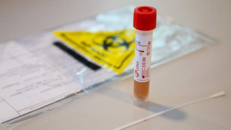 Currently, the Ministry of Health has 59 designated hospitals across Malaysia for Covid-19 screening. u00e2u20acu201d Picture via SoyaCincau