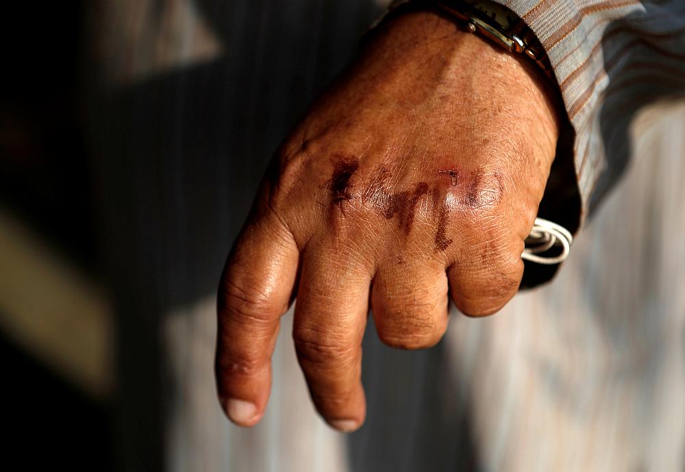 A man's hand is seen after washing off the home quarantine stamp during a nationwide lockdown to slow the spreading of Covid-19 on a street in Dharavi, Mumbai, India, April 11, 2020. u00e2u20acu201d Reuters pic