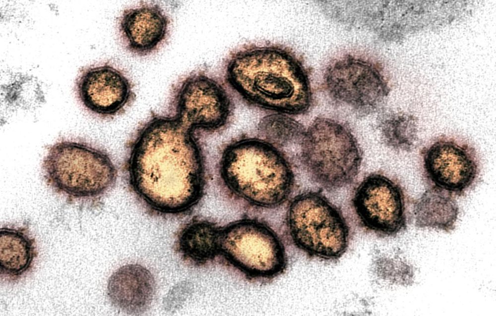 This transmission electron microscope image shows SARS-CoV-2, also known as novel coronavirus, the virus that causes Covid-19, isolated from a patient in the US. u00e2u20acu201d NIAID-RML/Handout via Reuters