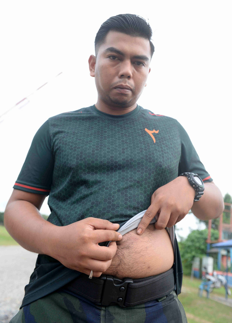 GOF personnel Lance Corporal Muhammad Amirul Amir showing his injury from a ball bearing ammunition in Bukit Kayu Hitam, November 26, 2020. u00e2u20acu201d Bernama pic 