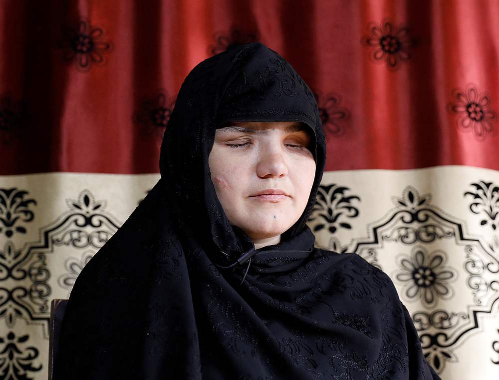 Khatera, 33, an Afghan police woman who was blinded after a gunmen attack in Ghazni province, speaks during an interview in Kabul, Afghanistan October 12, 2020. u00e2u20acu201d Reuters pic