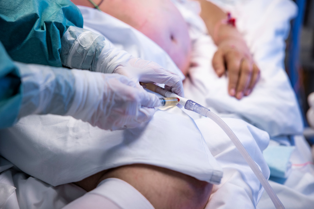 Picture taken November 27, 2020 shows the treatment of a patient infected with Covid-19 at the intensive care unit of Oslo University Hospital Rikshospitalet in Oslo, Norway. u00e2u20acu201d AFP pic 