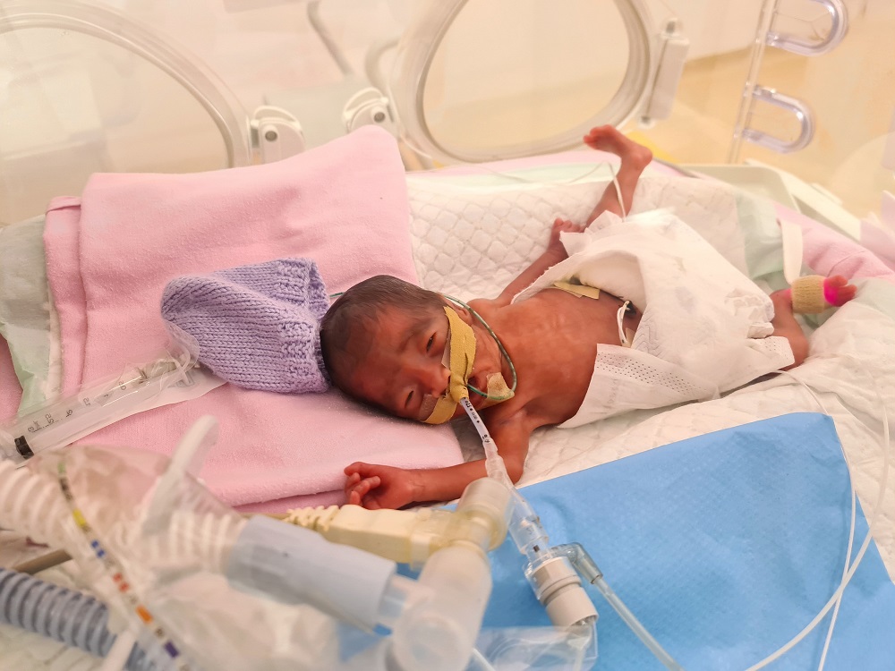 Micro preemie Eloise Ang Xuan Rui weighed only 670g at birth.  u00e2u20acu201d  Picture courtesy of One Hope Charity & Welfare