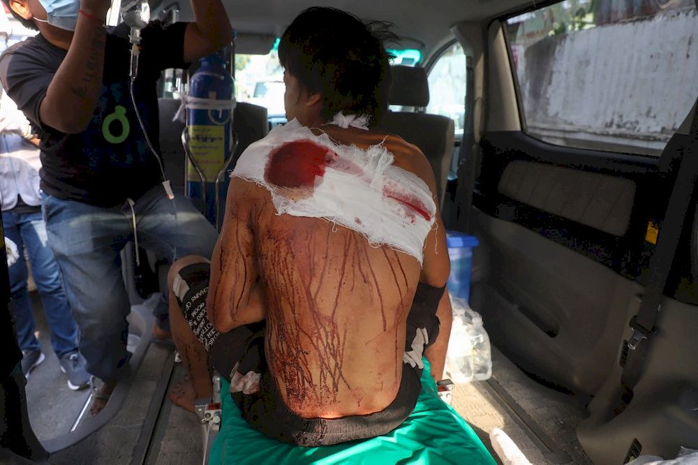 A protester, who was injured during a demonstration against the military coup, receives medical attention in a vehicle in Mandalay on April 1, 2021. u00e2u20acu201d AFP pic