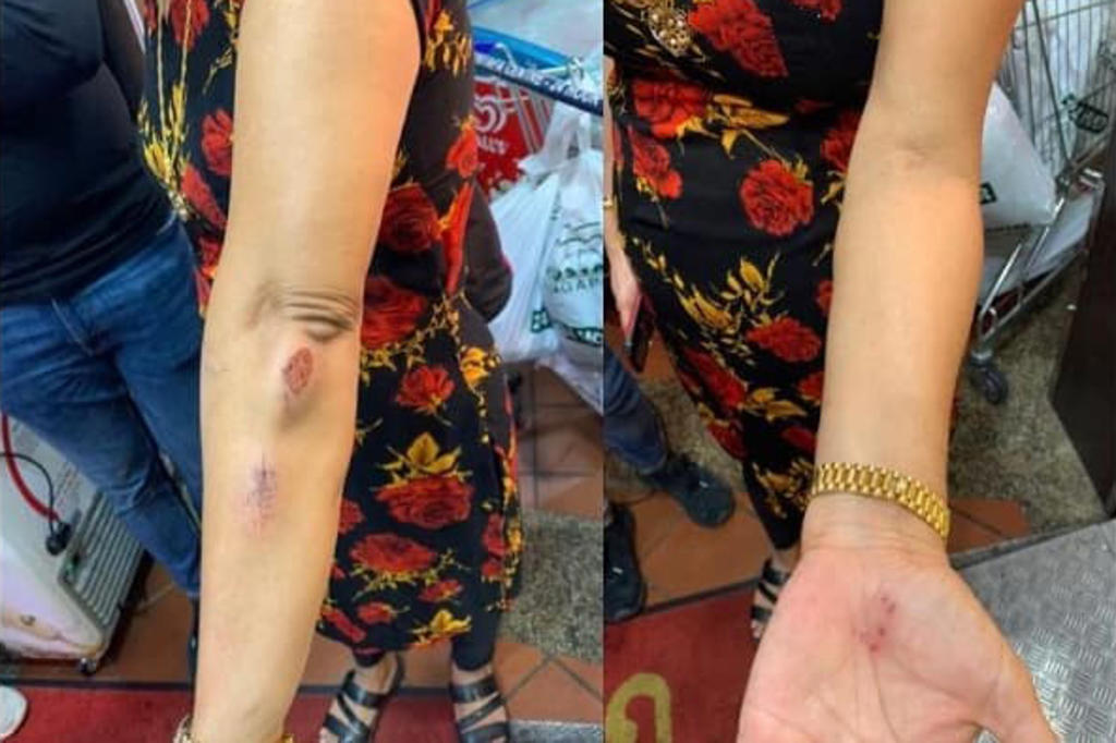 Hindocha Nita Vishnubhai was brisk-walking along Choa Chu Kang Drive on May 7, 2021, when a man approached her and asked her to pull her mask up from her chin. u00e2u20acu2022 Picture via Instagram/Parveen Kaur