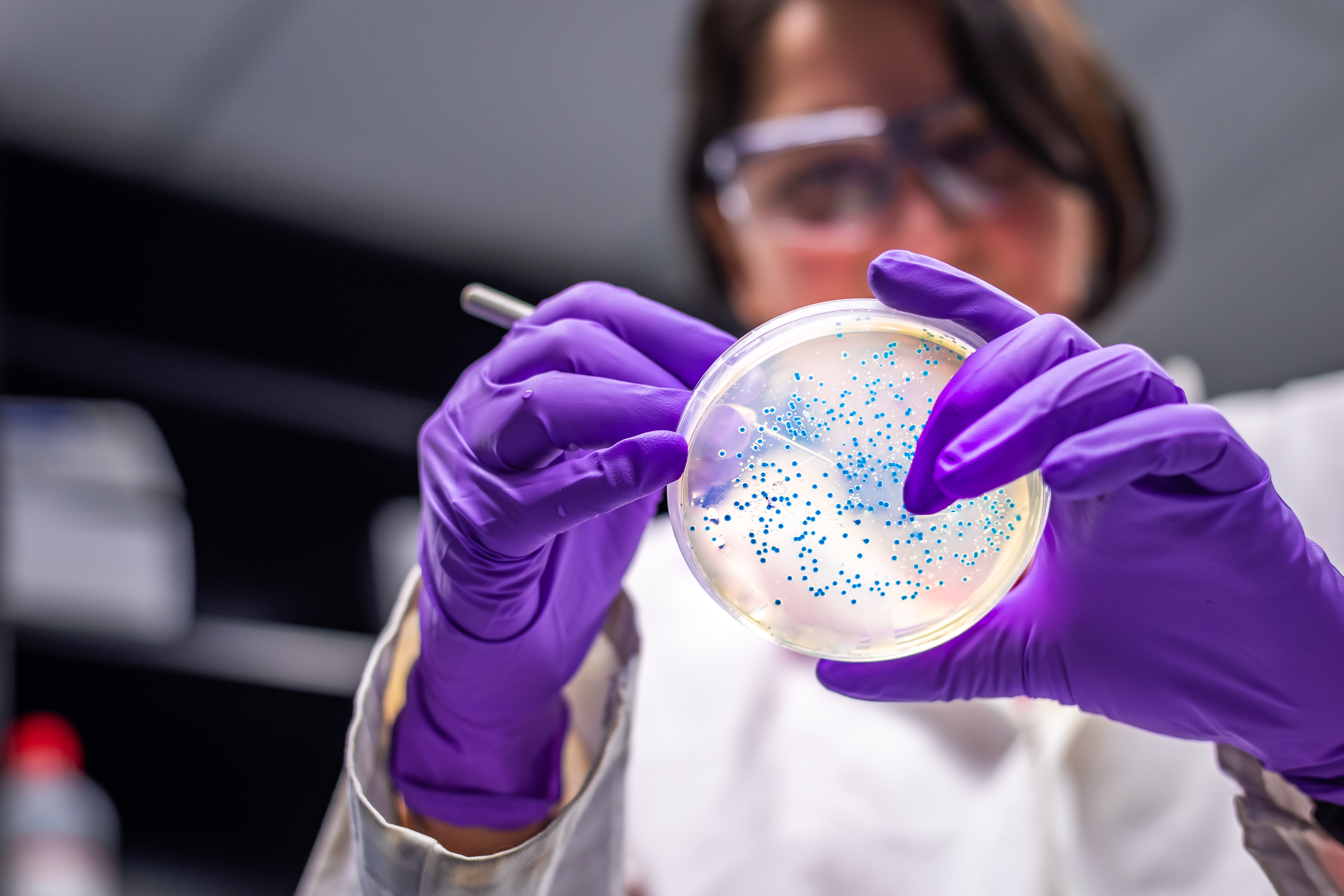 A scientist in a microbiology laboratory working with E coli culture. — iStock via TODAY