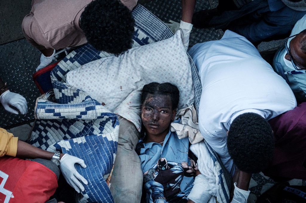 An injured resident of Togoga, a village about 20km west of Mekele, arrives on a stretcher to the Ayder referral hospital in Mekele, the capital of Tigray region, Ethiopia, on June 23, 2021. u00e2u20acu201d AFP pic