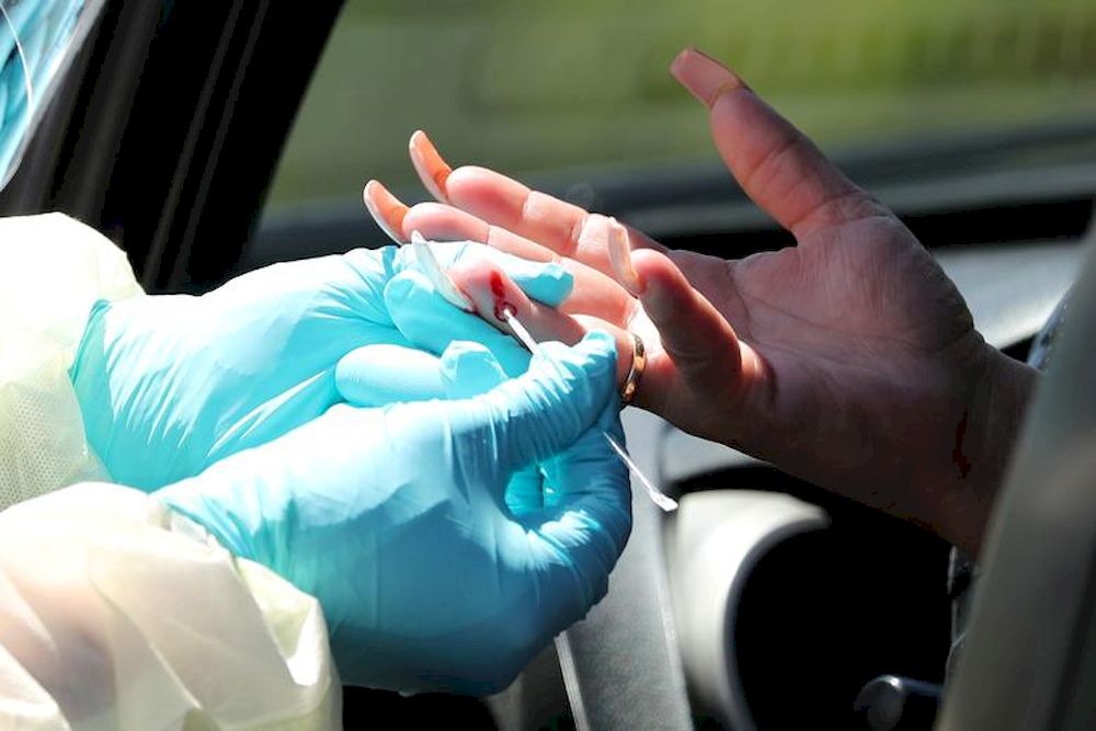 A healthcare worker administers a rapid, point of care pinprick coronavirus (Covid-19) IgM and IgG antibodies test at a myCovidMD free testing centre for under and uninsured people, in Los Angeles, California, US, April 24, 2020. u00e2u20acu201d Reuters pic