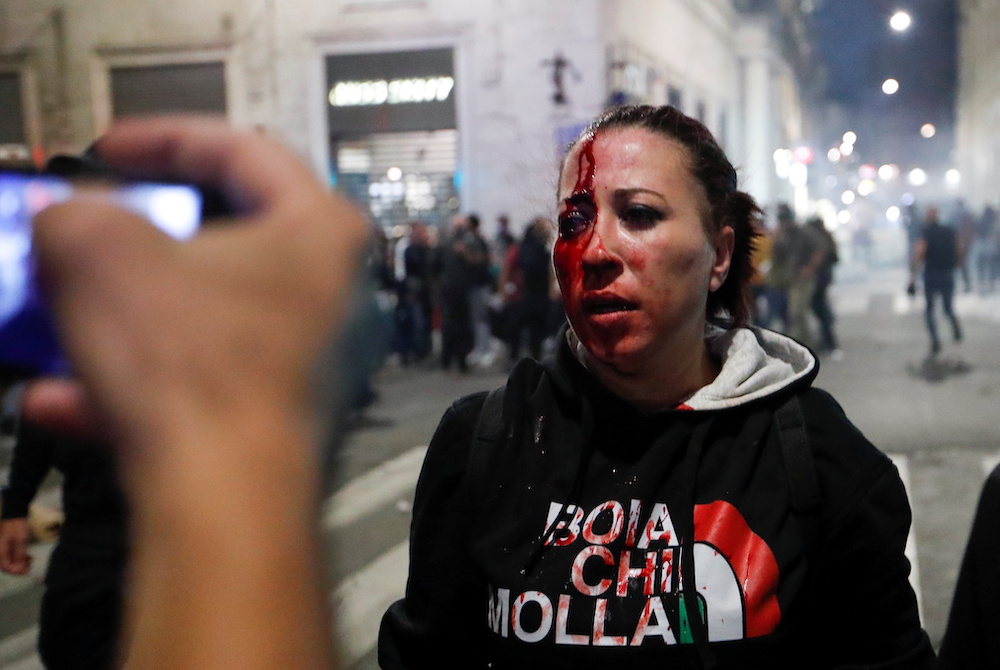 A demonstrator is injured during a protest against the government's introduction of the nu00e2u20acu02dcGreen Passu00e2u20acu2122 in Rome, Italy, October 9, 2021. u00e2u20acu201d Reuters pic n
