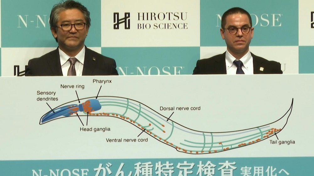 What a worm! Japan firm uses nematodes to sniff out cancer. u00e2u20acu201d AFP pic