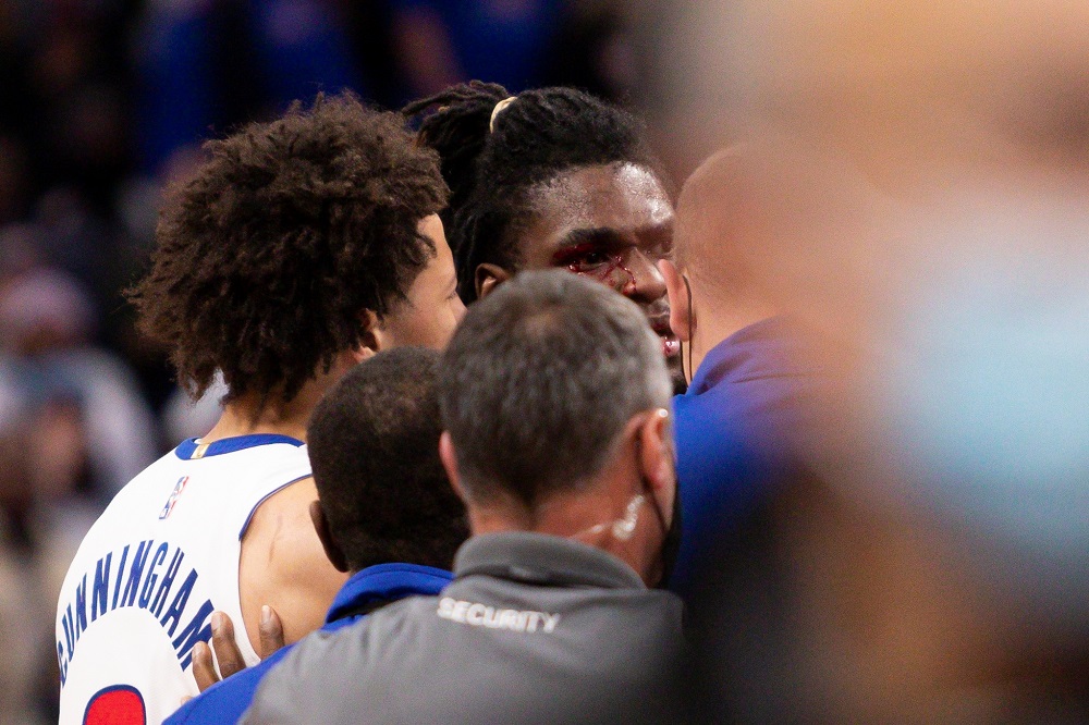 Detroit Pistons centre Isaiah Stewart (28) has blood around his right eye after an altercation with Los Angeles Lakers forward LeBron James (not pictured) during the third quarter at Little Caesars Arena. u00e2u20acu2022 Raj Mehta-USA TODAY Sports pic via Reuters