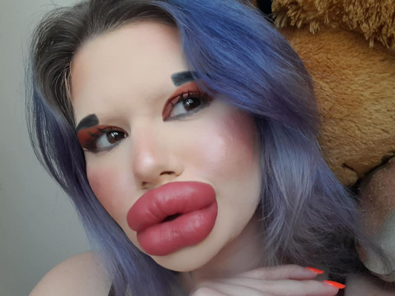 Bulgarian woman Andrea Ivanova will be getting her 27th lip filling this Christmas to live up to her biggest lips in the world title. u00e2u20acu201d Picture via Facebook/ Andrea Ivanovann