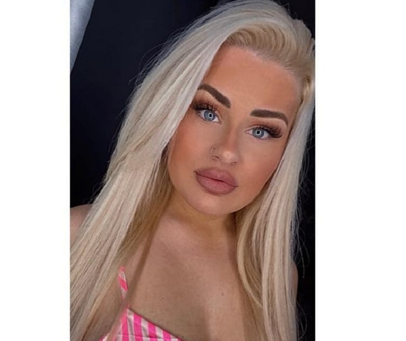 Daniella Bolton had to be rushed to the hospital after she suffered an extreme allergic reaction to lip filler dissolver. u00e2u20acu201d Picture via Facebook/ Dani Bolton