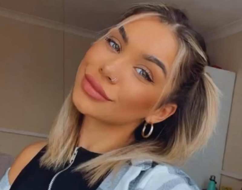 Cleo Symes was left with swollen lips after having her fillers dissolved. u00e2u20acu201d Picture from Facebook/ Cleo Symes
