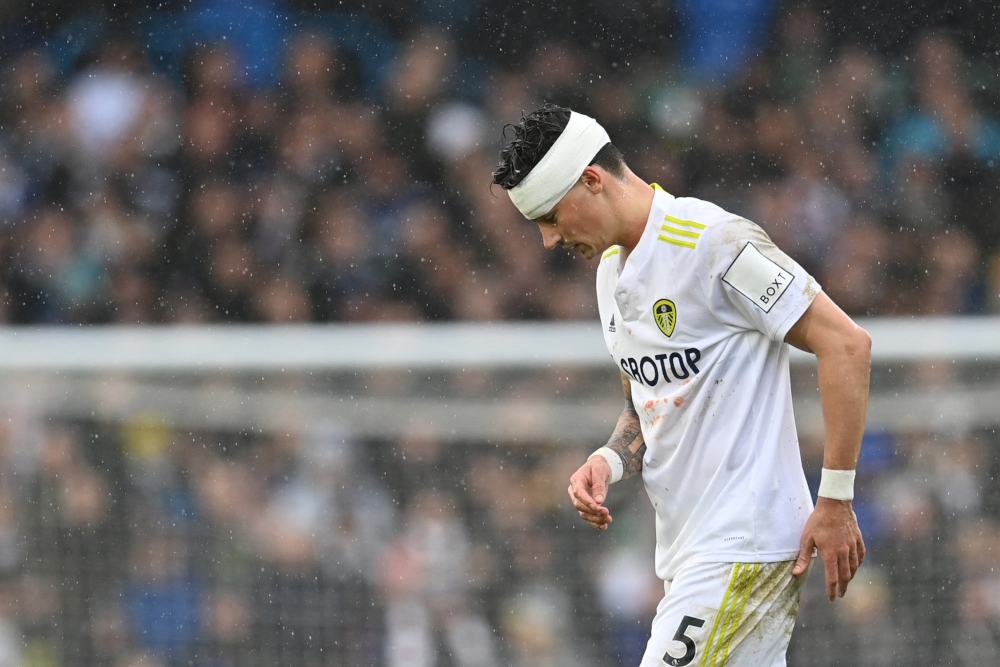 Leeds United defender Robin Koch reacts after receiving medication following a collision with Manchester United midfielder Scott McTominay at Elland Road in Leeds, northern England, February 20, 2022. u00e2u20acu201d AFP picnn