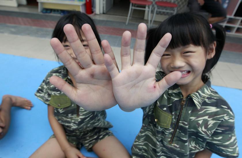 Kids calluses on their palms from physical training sessions in a kindergarten. u00e2u20acu201c Reuters pic