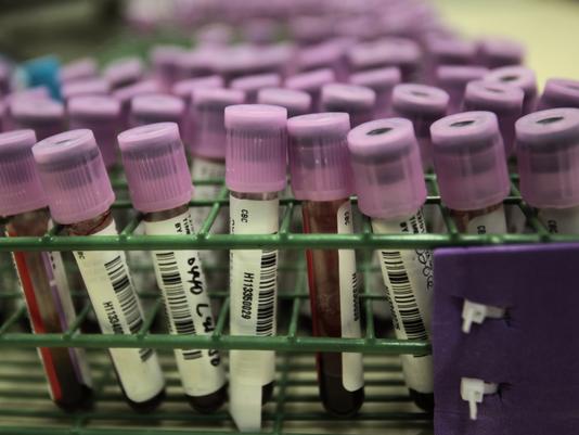 Some women and men had a mix of stress and urge incontinence. u00e2u20acu201c AFP pic